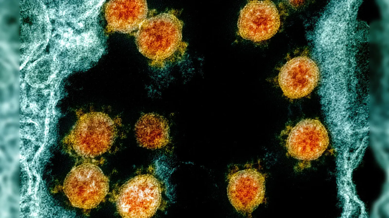 Elektronenmikroskopische Aufnahme des Coronavirus SARS-CoV-2. (Foto: Uncredited/NIAID/NIH/dpa)