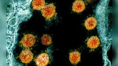 Elektronenmikroskopische Aufnahme des Coronavirus SARS-CoV-2. (Foto: Uncredited/NIAID/NIH/dpa)