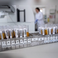 Blut ist nicht gleich Blut: Entscheidend für die Einsortierung in eine Blutgruppe ist, welche Antigene sich auf der Hülle der roten Blutkörperchen befinden. (Foto: Sven Hoppe/dpa/dpa-tmn)
