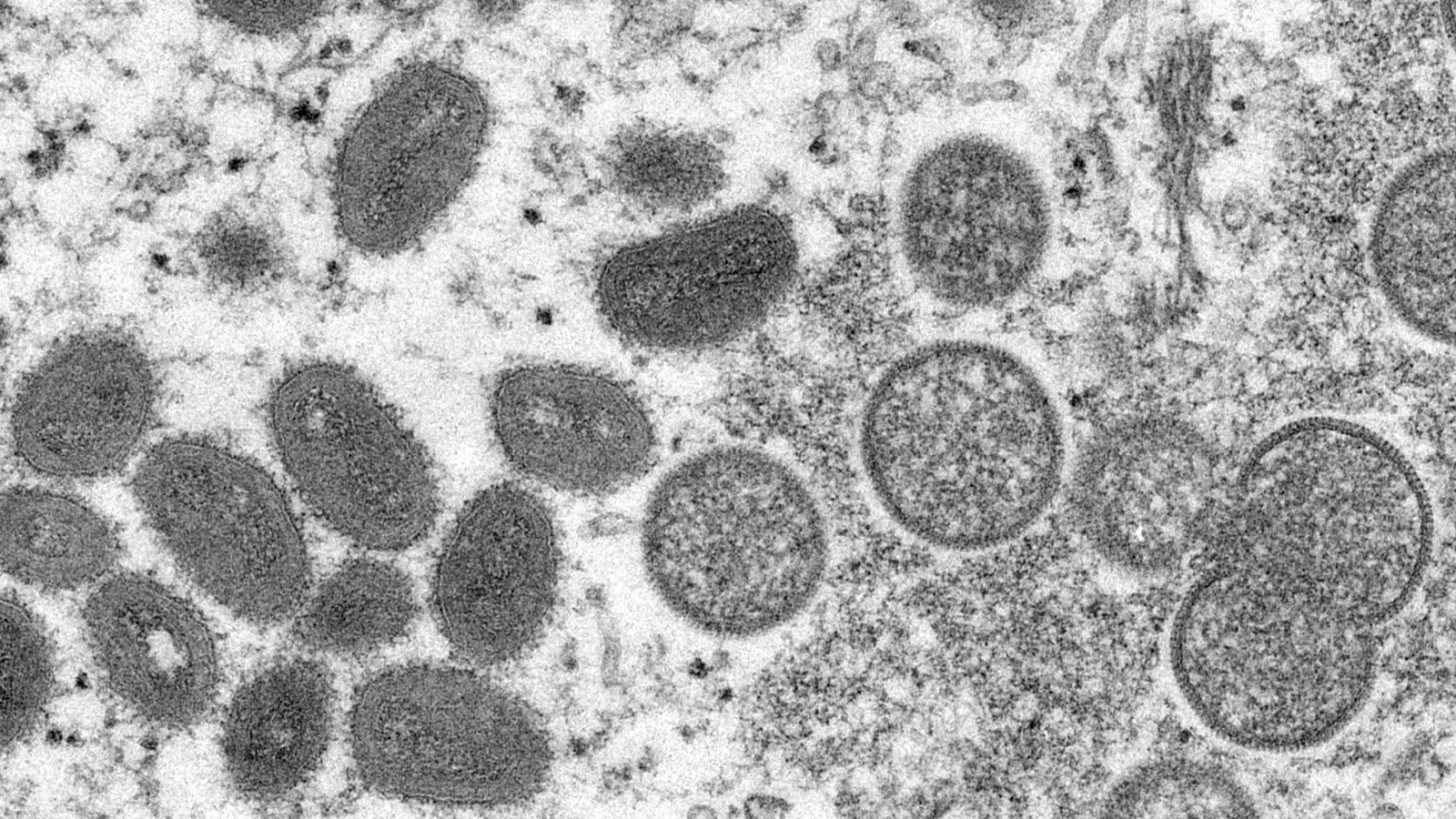 Diese elektronenmikroskopische Aufnahme zeigt reife, ovale Affenpockenviren (l) und kugelförmige unreife Virionen (r). (Foto: Cynthia S. Goldsmith/Russell Regner/CDC/AP/dpa)