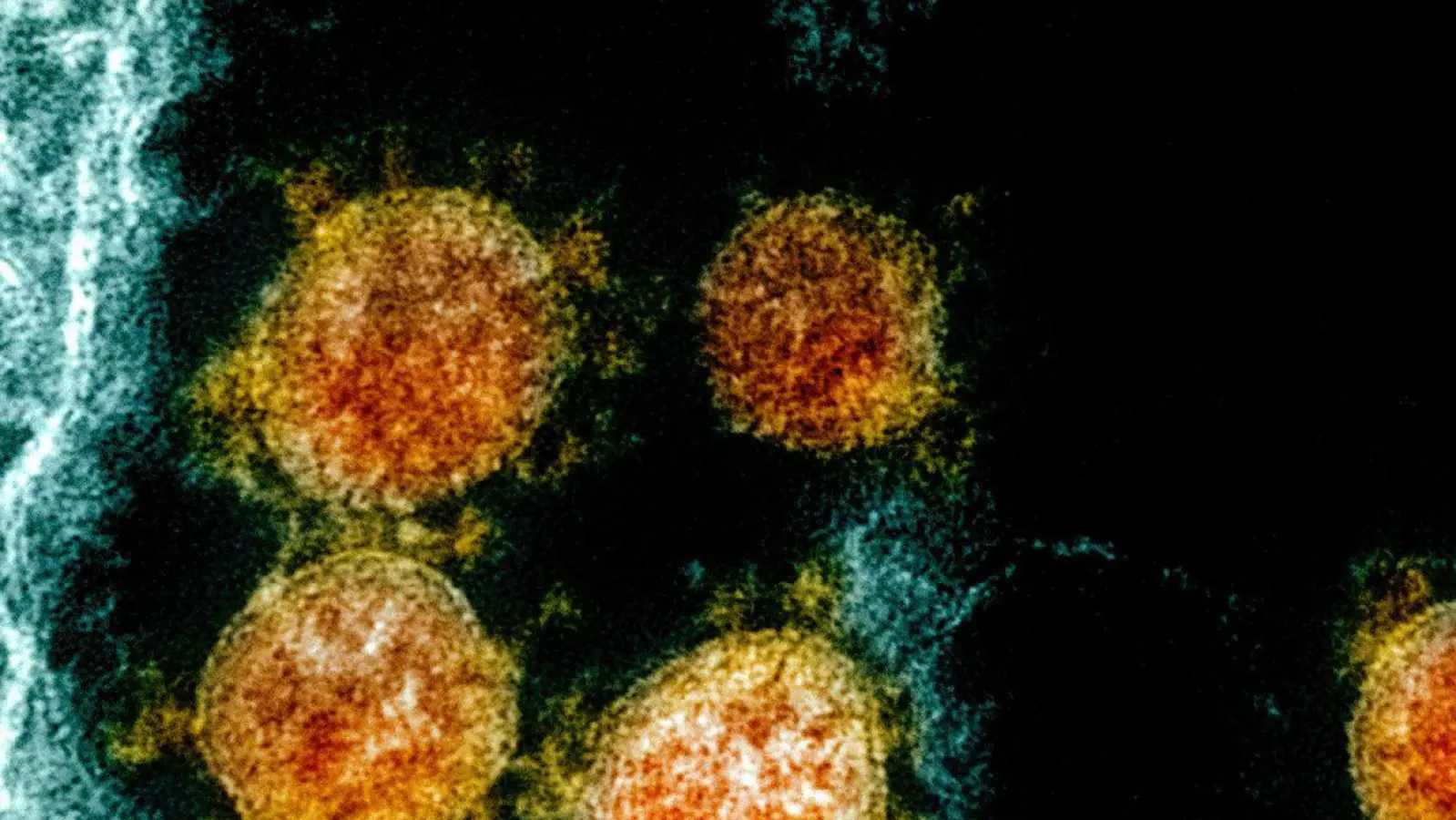 Partikel des Coronavirus SARS-CoV-2 wurden für eine elektronenmikroskopische Aufnahme farblich bearbeitet. (Foto: Uncredited/NIAID/NIH/dpa)