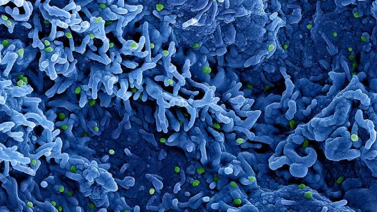 Eine kolorierte rasterelektronenmikroskopische Aufnahme des Affenpockenvirus (grün) auf der Oberfläche von infizierten VERO E6-Zellen (blau). (Foto: Niaid/Niaid/Planet Pix via ZUMA Press Wire/dpa)