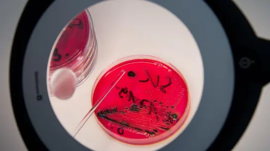 Nachgewiesene Salmonellen in einer Petrischale. (Foto: Arno Burgi/dpa-Zentralbild/dpa)