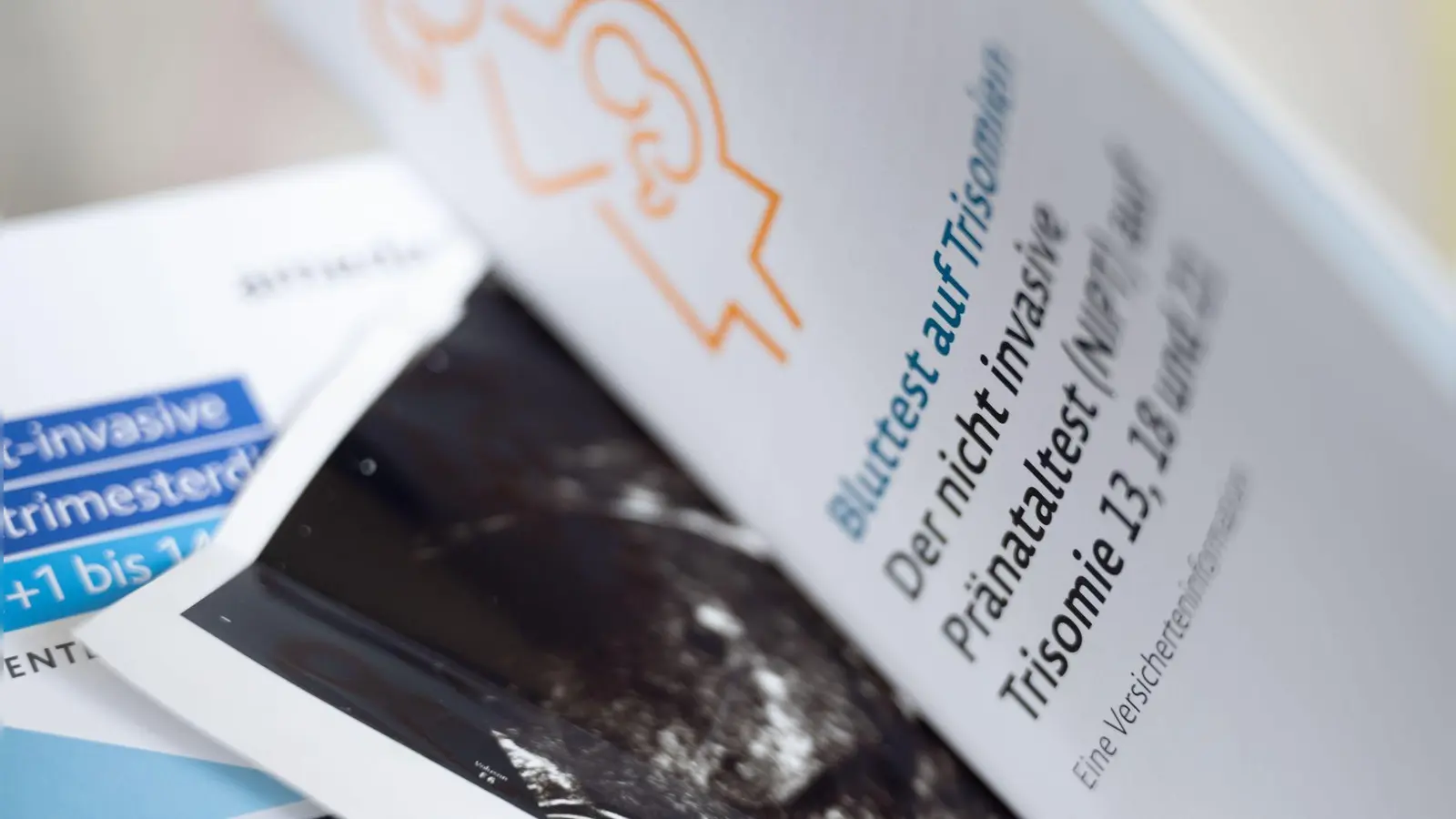 Jede zweite Schwangere in Bayern testet inzwischen auf Trisomien. (Symbolbild) (Foto: Hendrik Schmidt/dpa)