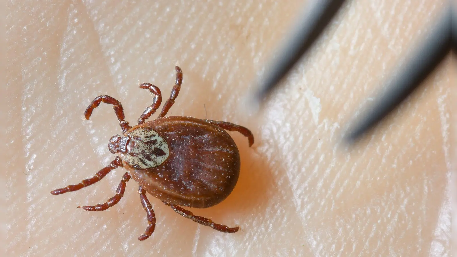Zecken sind inzwischen ganzjährig aktiv, sie erobern selbst kühle Berglagen und verbreiten das FSME-Virus in ganz Deutschland.(Symboldbild)  (Foto: Patrick Pleul/dpa-Zentralbild/dpa)