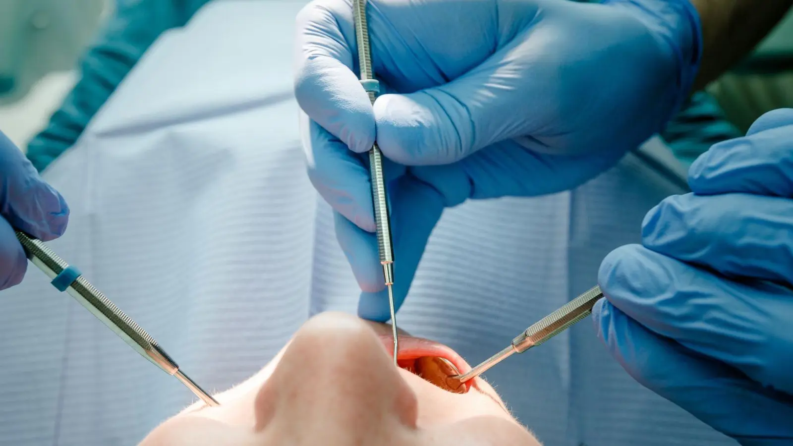 Zahnzusatzversicherungen früh abschließen: Ein früher Abschluss kann langfristig günstiger sein und Schutz vor hohen Kosten bieten. (Foto: Markus Scholz/dpa)