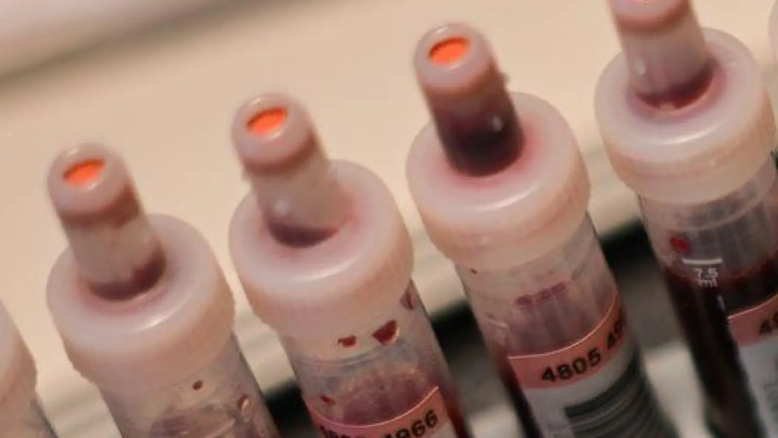 Vor allem in der Gruppe der 25-44-Jährigen treten sexuell übertragbare Krankheiten auf. (Archivbild) (Foto: Sebastian Gollnow/dpa)