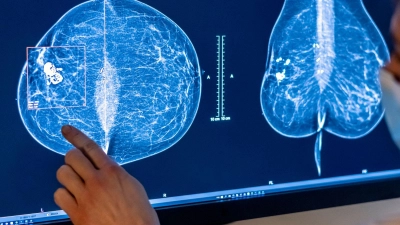 2023 wurden rund eine halbe Million Menschen in Deutschland mit Krebs diagnostiziert. (Symbolbild) (Foto: Hannibal Hanschke/dpa)