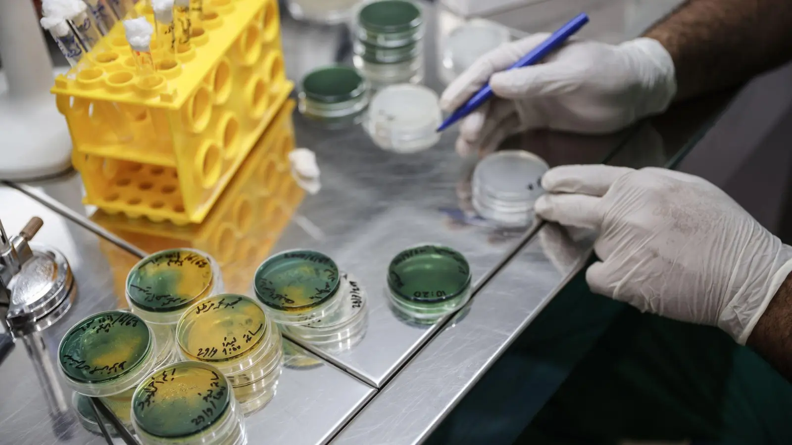 Ein Labortechniker bearbeitet Proben von Choleraverdachtsfällen in einem medizinischen Labor. (Foto: Anas Alkharboutli/dpa)