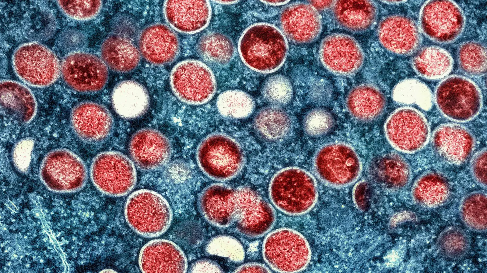 So sieht es unter dem Mikroskop aus: In der zentralafrikanischen Demokratischen Republik Kongo breitet sich das Mpox-Virus aus. (Foto: National Institute of Allergy and Infectious Diseases/AP/dpa)