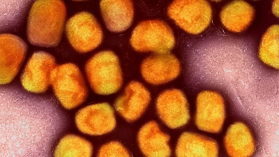 Eine kolorierte ektronenmikroskopische Aufnahme von Partikeln des Affenpockenvirus (Gold), kultiviert und gereinigt aus einer Zellkultur. (Foto: Niaid/Niaid/Planet Pix via ZUMA Press Wire/dpa)