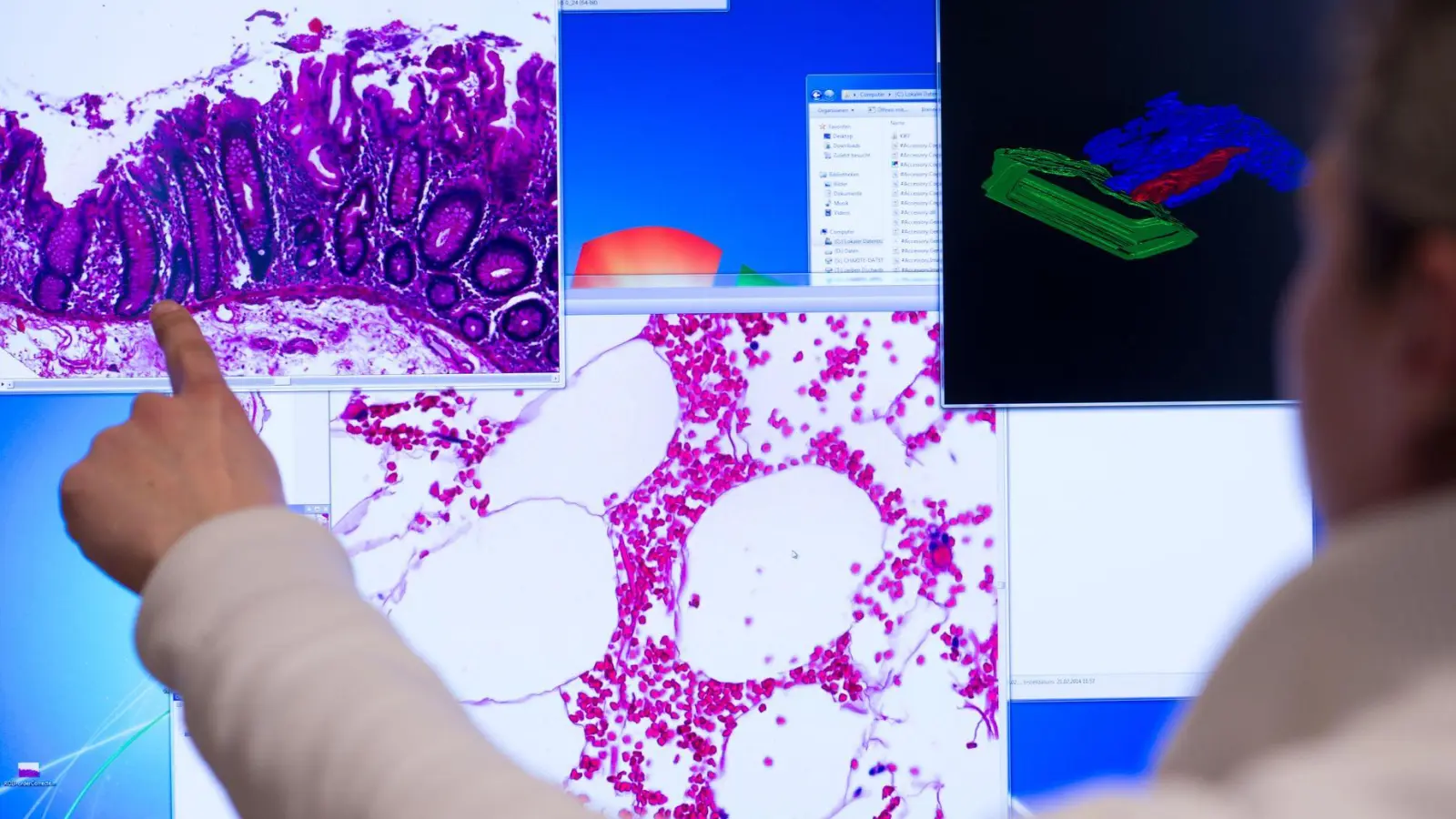 Die Diagnostik hat sich seit Jahren verbessert - nicht nur bei der Behandlung von Darmkrebs, auch bei der Früherkennung. (Illustration)  (Foto: Bernd von Jutrczenka/dpa)