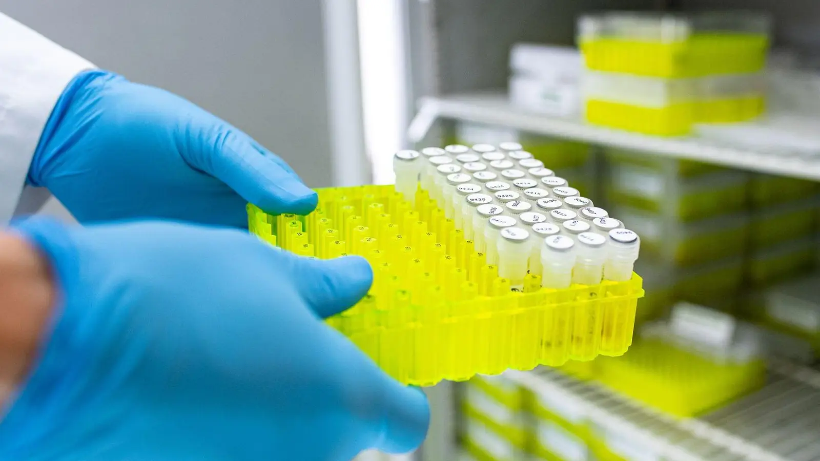 Ehec steht für enterohämorrhagische Escherichia coli und bezeichnet bestimmte krankmachende Stämme dieses im Darm vorkommenden Bakteriums. (Foto: Guido Kirchner/dpa)