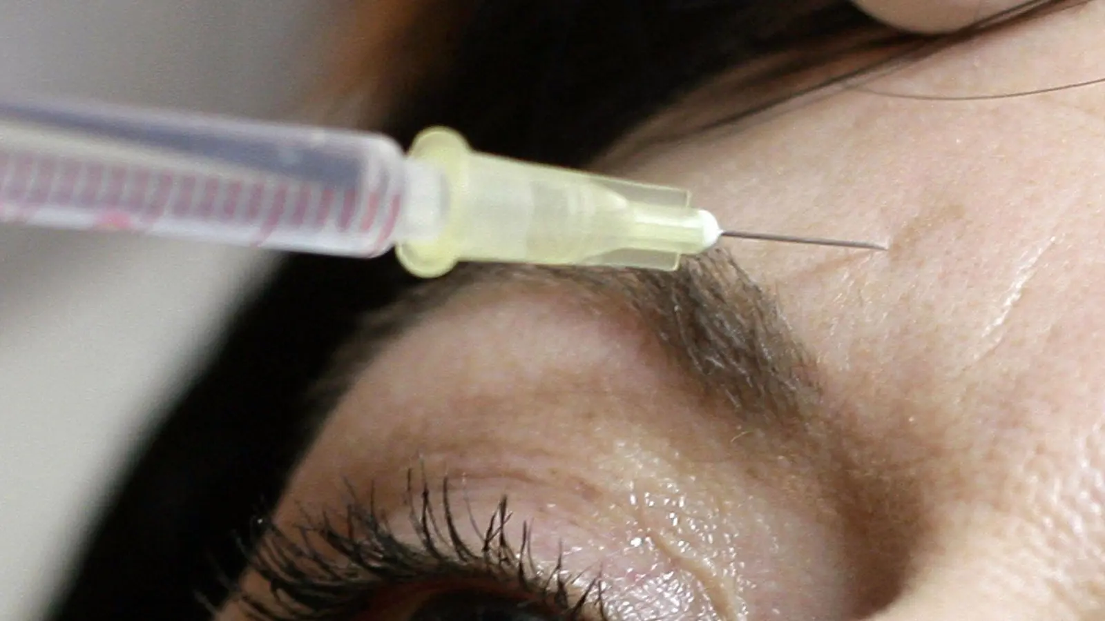 Am BGH geht es um sogenannte minimalinvasive Schönheitsbehandlungen. (Symbolbild) (Foto: Peer Grimm/dpa-Zentralbild/dpa)