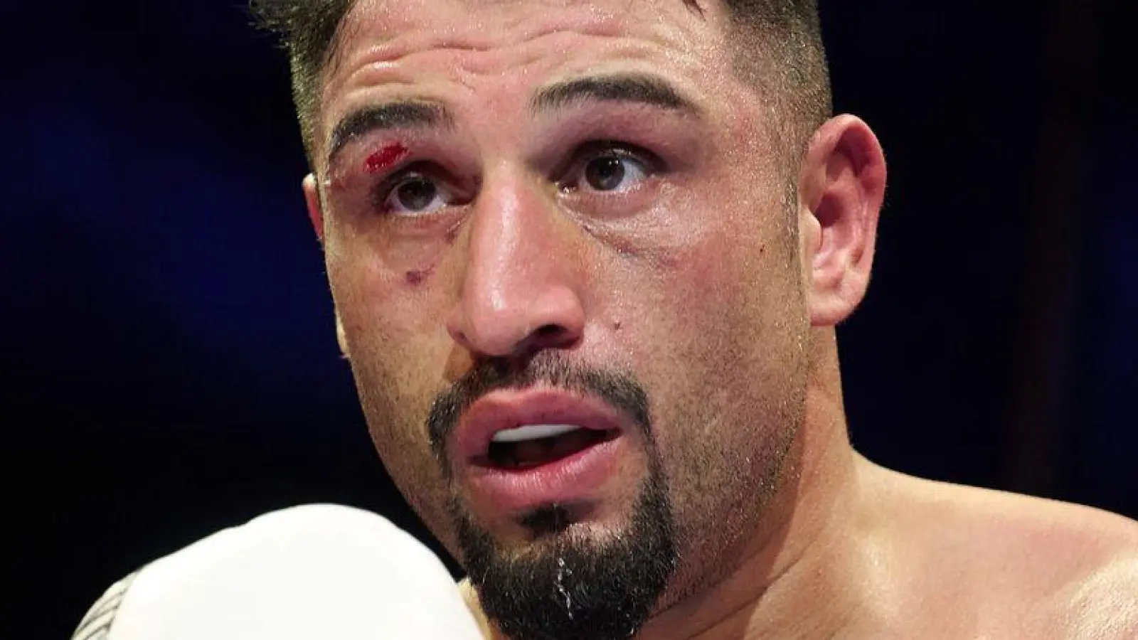 Darf auf den Kampf seines Lebens hoffen: Agit Kabayel. (Archivbild) (Foto: Bernd Thissen/dpa)