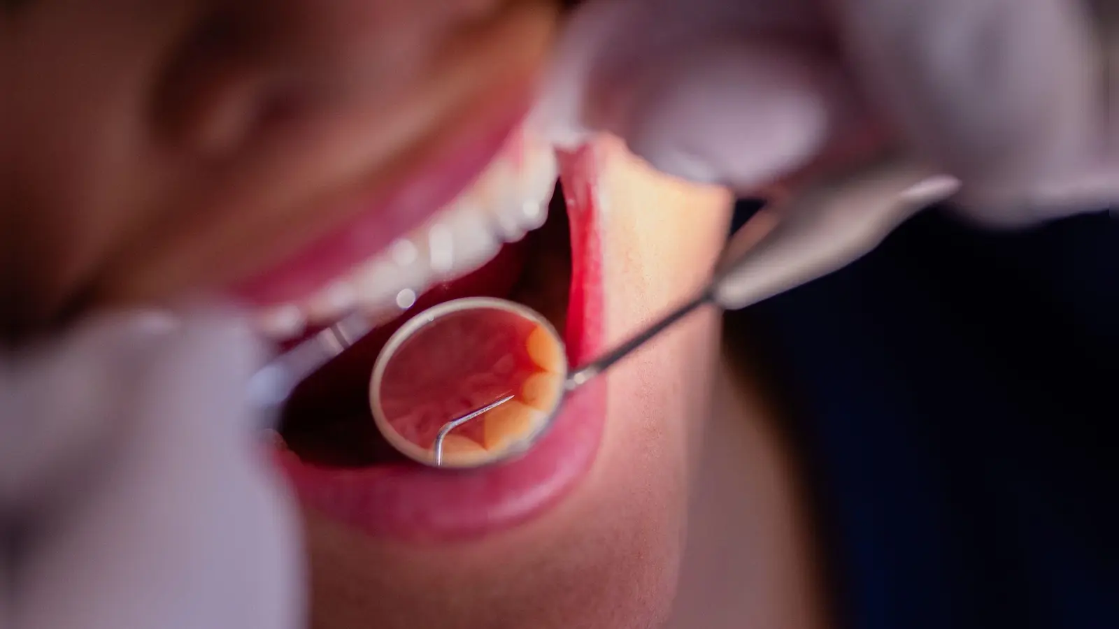 Zahnarztbehandlungen sollen nach dem Willen des CDU-Wirtschaftsrats „nicht länger im Umlageverfahren den Beitragszahlern zur Last fallen“. (Symbolbild) (Foto: Rolf Vennenbernd/dpa)