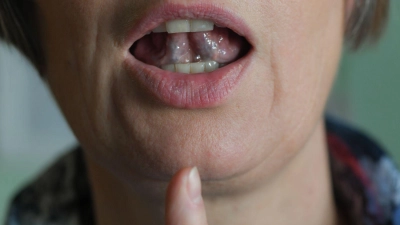 Stotternde Menschen können mit Hilfe von regelmäßigen Sprechübungen ihren Redefluss verbessern. (Symbolbild) (Foto: Jens Kalaene/zb/dpa)