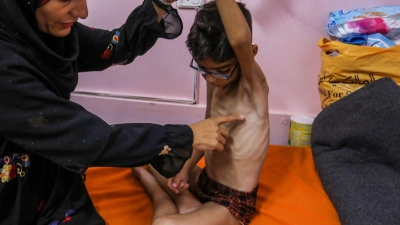 Kinder unter fünf Jahren sind bei Mangelernährung in Lebensgefahr. (Archivbild) (Foto: Abed Rahim Khatib/dpa)