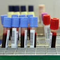 „Blut spenden heißt Leben retten”: Am Sonntag ist Weltblutspendetag. (Symbolbild: Fabian Hähnlein)