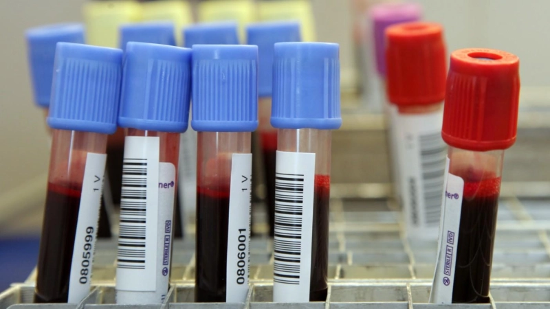 „Blut spenden heißt Leben retten”: Am Sonntag ist Weltblutspendetag. (Symbolbild: Fabian Hähnlein)