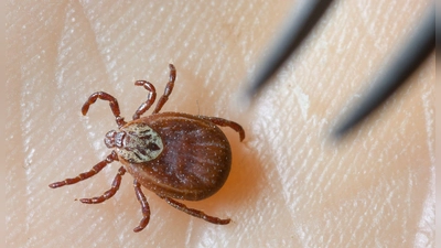 Es ist auch mit weiter steigenden Zahlen zu rechnen, warnte die Stuttgarter Parasitologin Ute Mackenstedt im Vorfeld des 8. Süddeutschen Zeckenkongress in Stuttgart.(Symbolbild) (Foto: Patrick Pleul/dpa-Zentralbild/dpa)