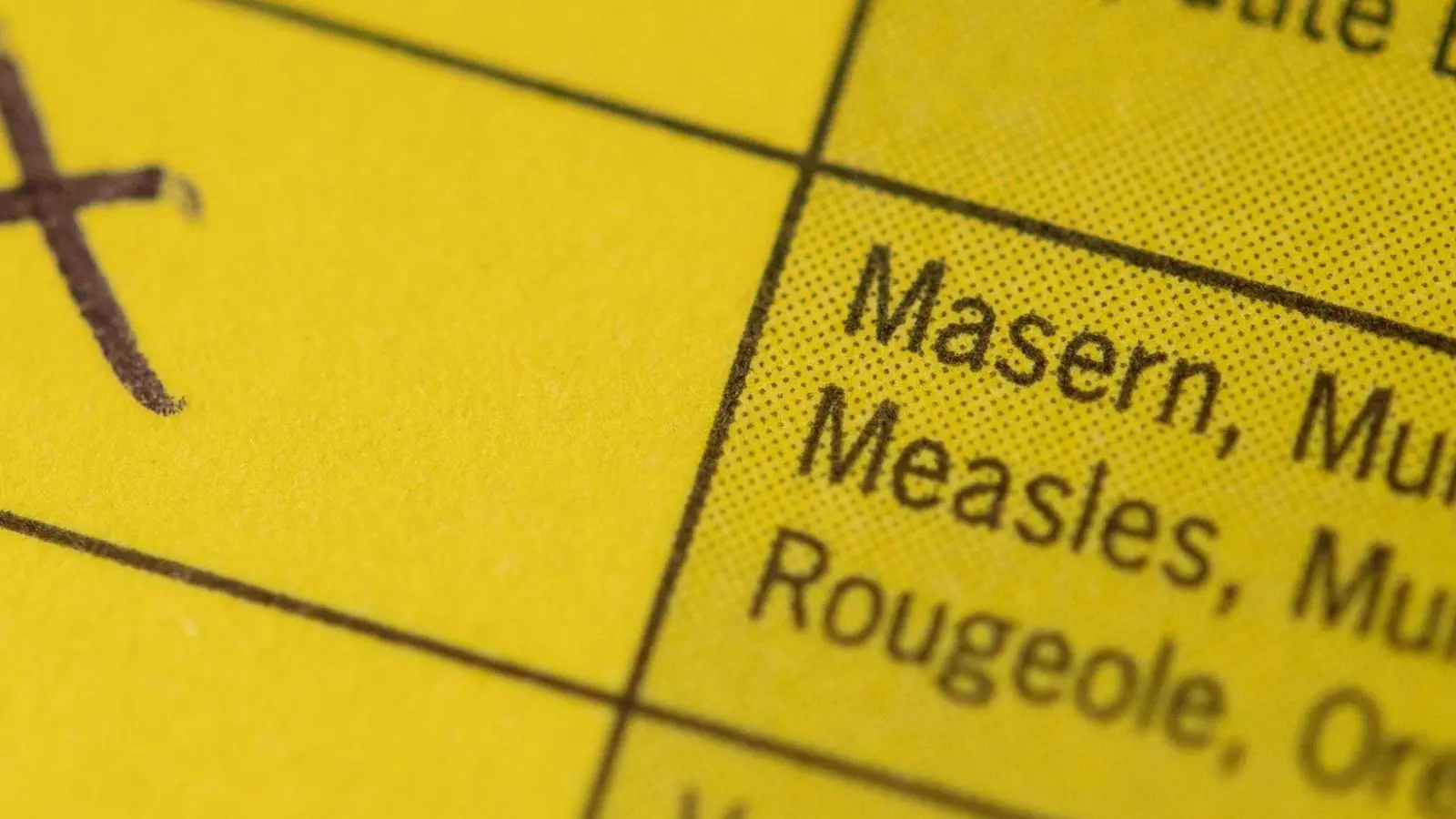 Im Landkreis Freyung-Grafenau gibt es aktuell sechs Masernfälle. (Symbolbild) (Foto: Marius Becker/dpa)