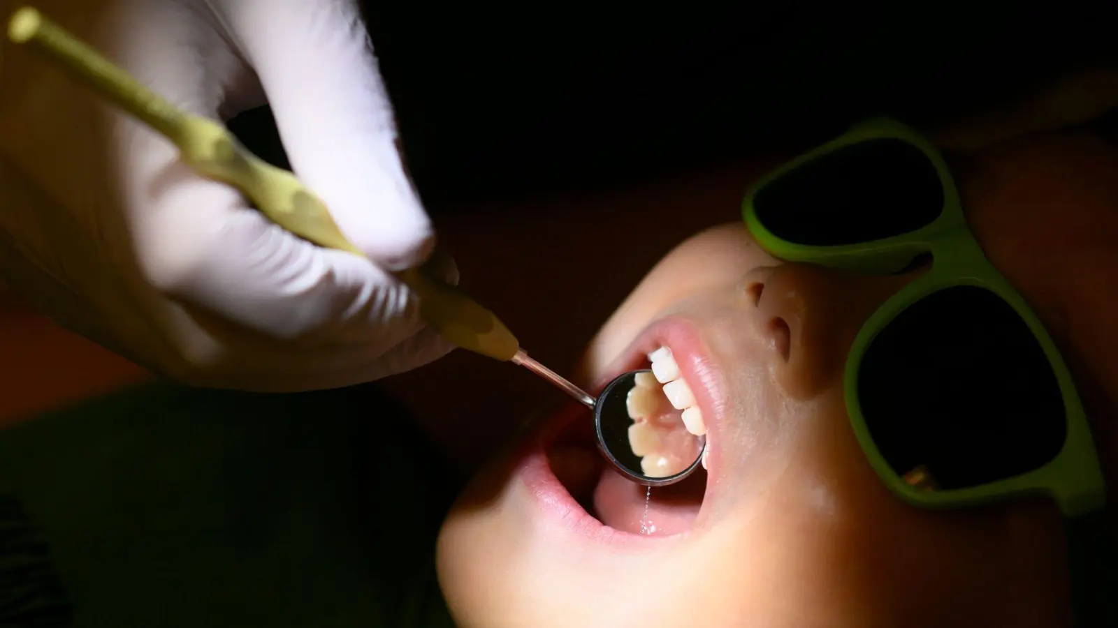 Gesetzliche Krankenkassen übernehmen regelmäßige Zahnarztchecks. (Foto: Julian Stratenschulte/dpa/dpa-tmn)
