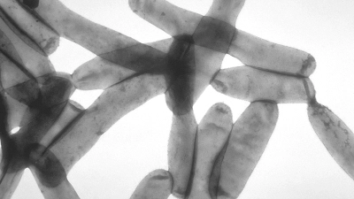 So sehen Legionellen unter dem Elektronenmikroskop aus. In einem Anwesen in der Ansbacher Altstadt machen die Bakterien seit Monaten Probleme. (Foto: Public Domain/CDC (Phil #1187))