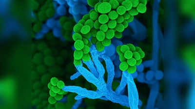 Penicillium bedeutet auf Lateinisch „kleiner Pinsel“, weil die Zellketten mit Sporen am Ende so ähnlich aussehen (Handout) (Foto: Ulrich Kück/ Birgit Hoff/Vereinigung für Allgemeine und Angewandte Mikrobiologie/dpa)