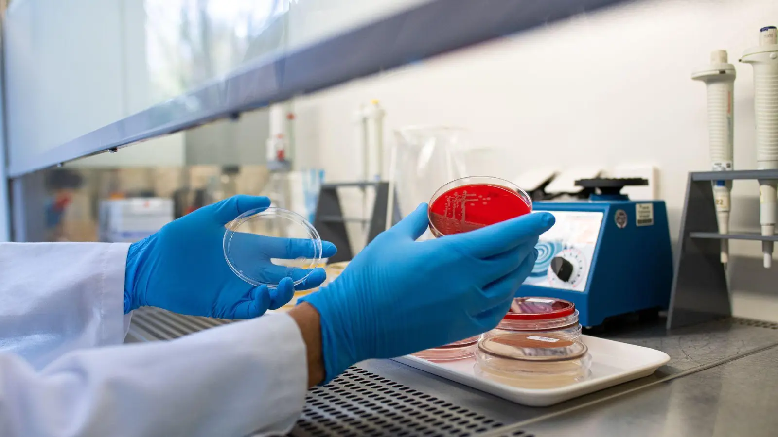 Die Zahl der registrierten Ehec-Infektionen in Mecklenburg-Vorpommern hat sich auf 22 erhöht. (Symbolbild) (Foto: Guido Kirchner/dpa)