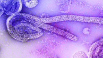 Eine elektronenmikroskopische Aufnahme eines  Marburg-Virus. (Foto: Dr. Frederick Murphy/CDC/dpa)