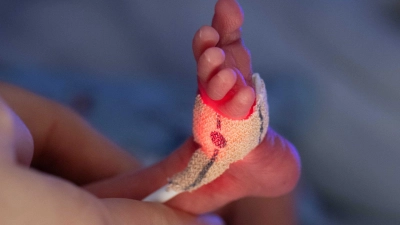 Darmkeim-Infektionen können vor allem für besonders vulnerable Patienten, wie etwa Frühchen, gefährlich werden. (Symbolbild) (Foto: Boris Roessler/dpa)