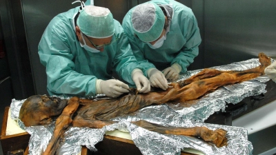 Ötzi wurde hundertfach untersucht (Foto: M.Samadelli/Southtyrolarchaeologymuseum\Eurac via Eurekalert/dpa)