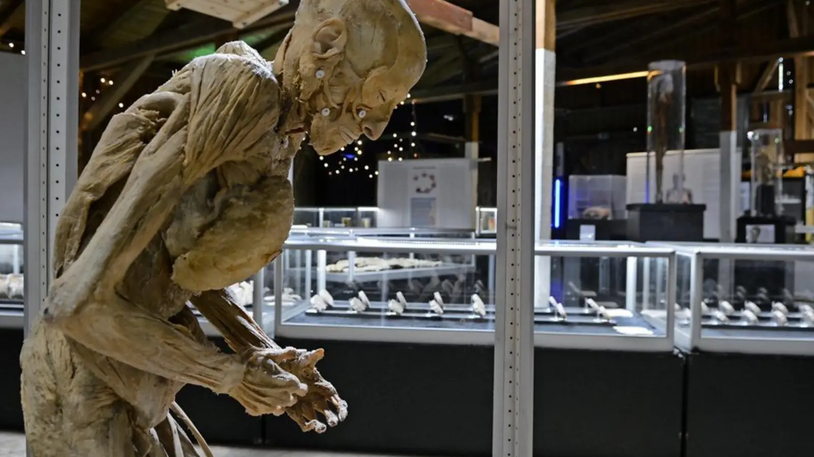 Geschmackssache: bei der Ausstellung die in den Stadthallen von Feuchtwangen und Windsbach Station macht werden echte Körper gezeigt. (Foto: Christine Hinzmann)