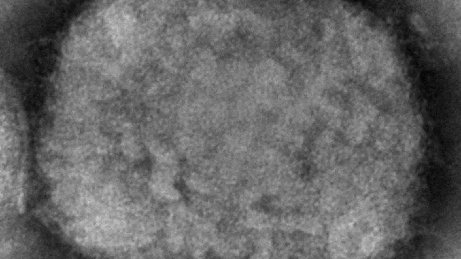 Diese elektronenmikroskopische Aufnahme zeigt ein Affenpockenvirus. (Foto: Cynthia S. Goldsmith/CDC via AP/dpa)