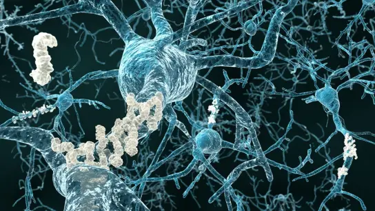 Eiweißablagerungen zwischen den Nervenzellen (Plaques) sind zum Teil ursächlich für Alzheimer-Symptome. (Foto: Juan Gaertner/Shutterstock/obs)
