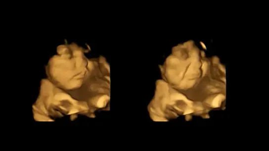 Bereits im Mutterleib reagieren Babys positiv oder negativ auf manche Lebensmittel, wie die Wissenschaftler der nordostenglischen Universität Durham herausfanden. (Foto: FETAP Study/Fetal and Neonatal Research Lab/Durham University/dpa)