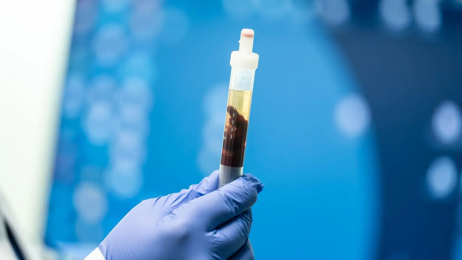 In Kalifornien konnte eine Pest-Infektion nachgewiesen werden (Foto: Silas Stein/dpa)