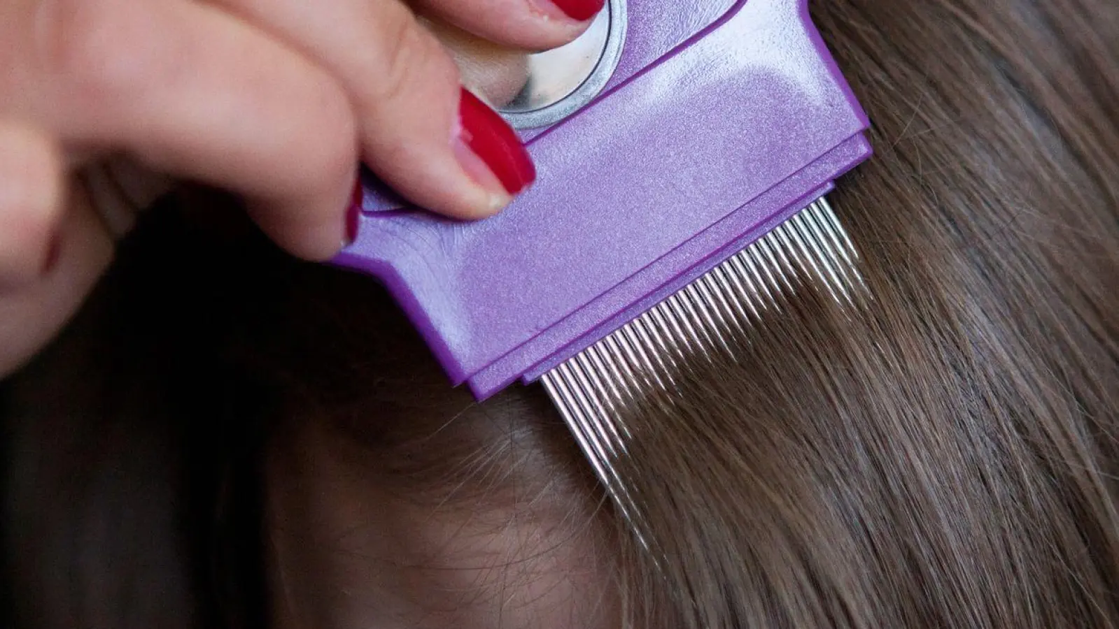 Lästig, aber ungefährlich: Kopfläuse wird man am besten mit Haarpflegespülung und einem Läusekamm los. (Foto: Silvia Marks/dpa-tmn)