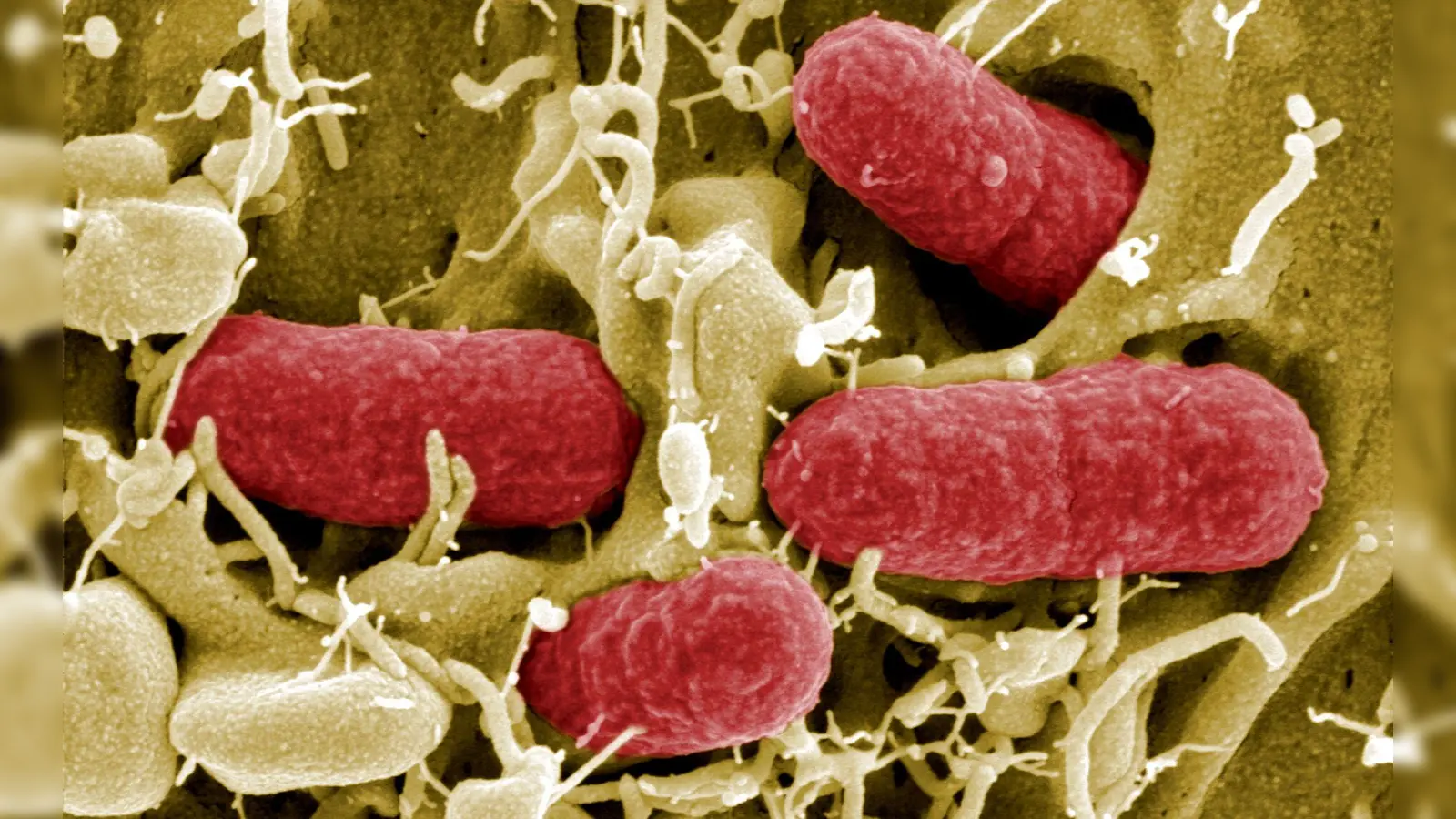 Die Quelle der aktuellen Infektionen ist in keinem der Fälle bekannt. (Archivbild) (Foto: Manfred Rohde/HZI/HZI/dpa)