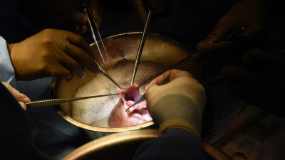 Chirurgen führen die Transplantation des Schweineherzens im Krankenhaus in Baltimore durch. (Foto: Mark Teske/University of Maryland School of Medicine/dpa)