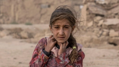 Die Lage für Kinder in Afghanistan ist lebensbedrohlich. (Foto: Ebrahim Noroozi/AP/dpa)
