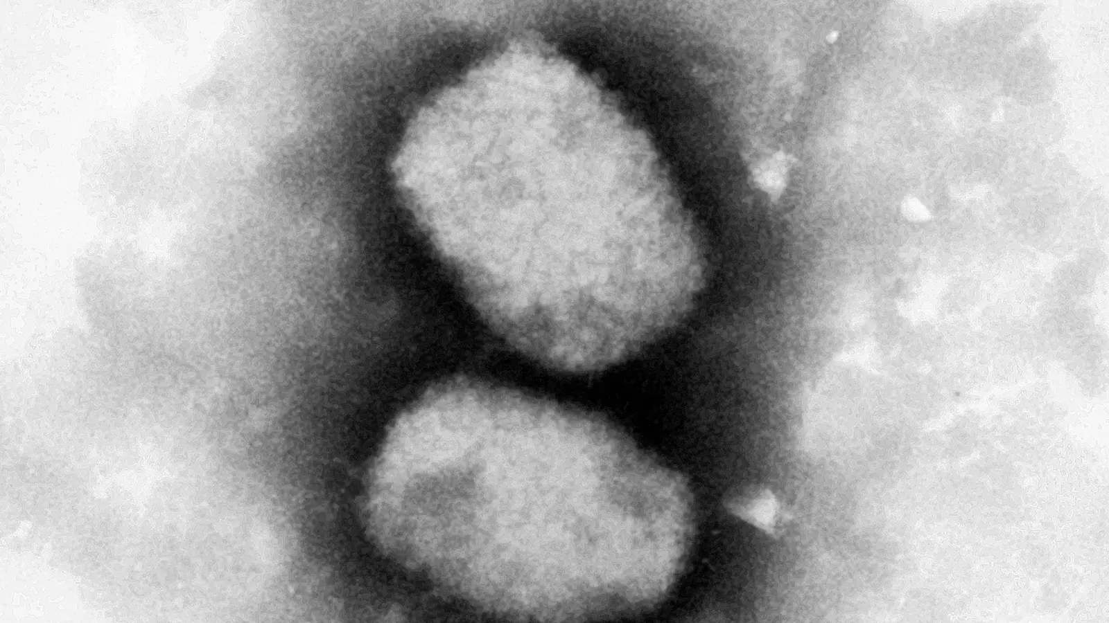 Diese vom RKI zur Verfügung gestellte elektronenmikroskopische Aufnahme zeigt das Affenpockenvirus. (Foto: Andrea Männel/RKI/dpa)