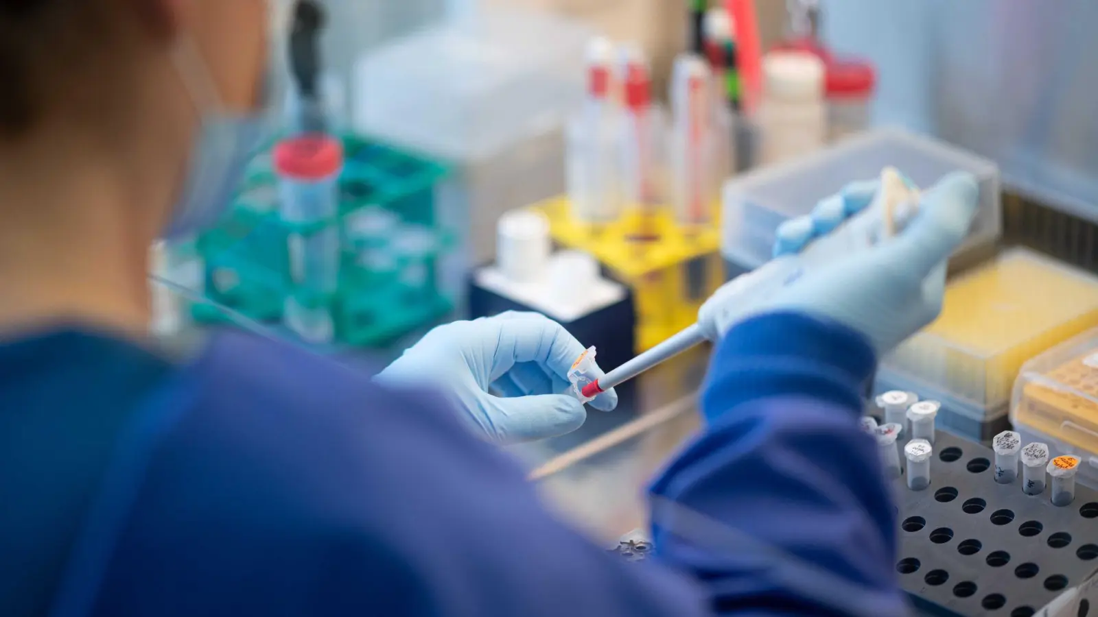 Der Ursprung des Virus Sars-CoV-2 bleibt unklar. (Symbolbild) (Foto: Daniel Reinhardt/dpa)