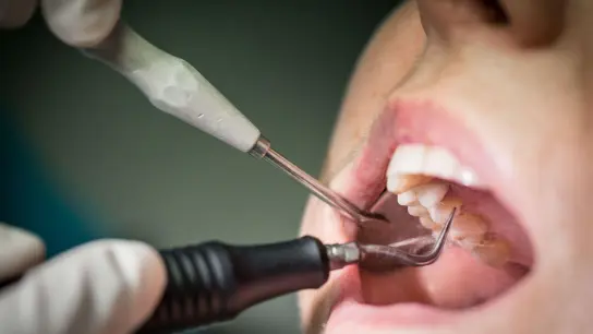 Wer regelmäßig zur Vorsorge geht und seine Zähne professionell reinigen lässt, kann Parodontitis vorbeugen. Besonders wichtig ist das für Diabetiker. (Foto: Frank Rumpenhorst/dpa-tmn)