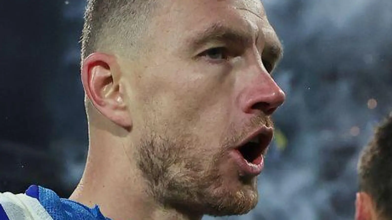 Edin Dzeko wurde direkt verarztet. (Foto: Armin Durgut/AP/dpa)