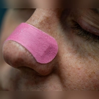 Nasenpflaster werden quer über den Nasenrücken geklebt und können die Nasenflügel sanft anheben, um die Atmung zu erleichtern. (Foto: Zacharie Scheurer/dpa-tmn)
