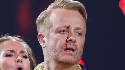 Tapfer tanzte Ross Antony weiter - trotz seiner Verletzung.  (Foto: Rolf Vennenbernd/dpa)