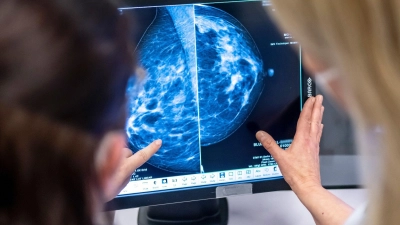 Medizinisches Personal untersucht mit einer Mammographie die Brust einer Frau auf Brustkrebs. (Foto: Hannibal Hanschke/dpa)