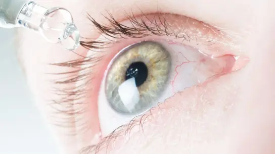 Das Auge ist von feinen Blutgefäßen durchzogen. Dass da mal eines platzt und für ein blutrotes Auge sorgt, lässt sich kaum vermeiden. (Foto: Franziska Gabbert/dpa-tmn)